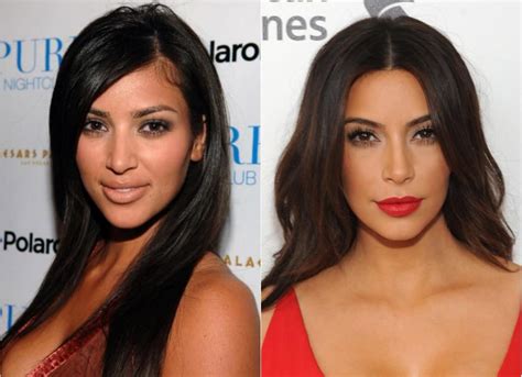 How Much Plastic Surgery Has Kim Kardashian Had: Exploring the Intersection of Celebrity Culture and Cosmetic Enhancements