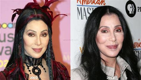 Who is Cher's Plastic Surgeon: A Journey Through Speculation and Admiration